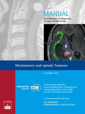 cover image of Hirntumoren und spinale Tumoren